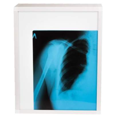 Негатоскоп медицинский1_1